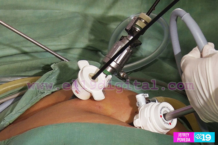 Operan hernias y vesículas en Hospital Manolo Morales