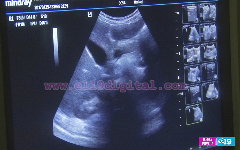 Hospital La Mascota realiza jornada de ultrasonidos