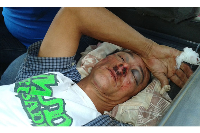 Mortal accidente de tránsito entre El Rosario y Murra