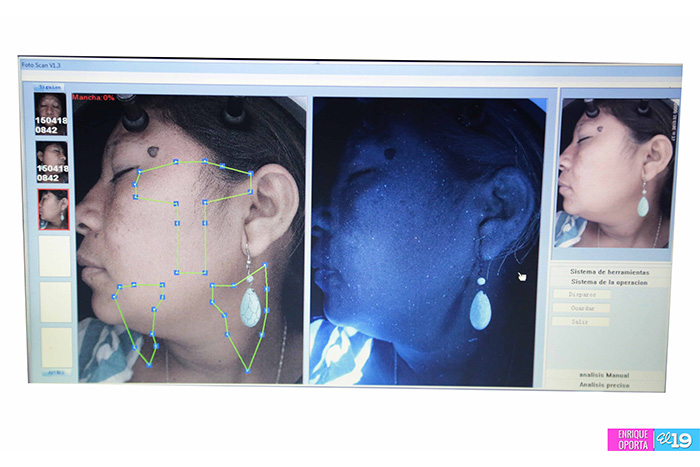 Realizan jornada dermatológica en el Centro Nacional de Dermatología