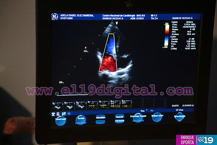 Centro Nacional de Cardiología desarrolla Jornada de exámenes del corazón