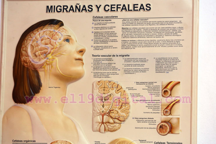 Realizan jornada de electroencefalogramas en Hospital Psicosocial
