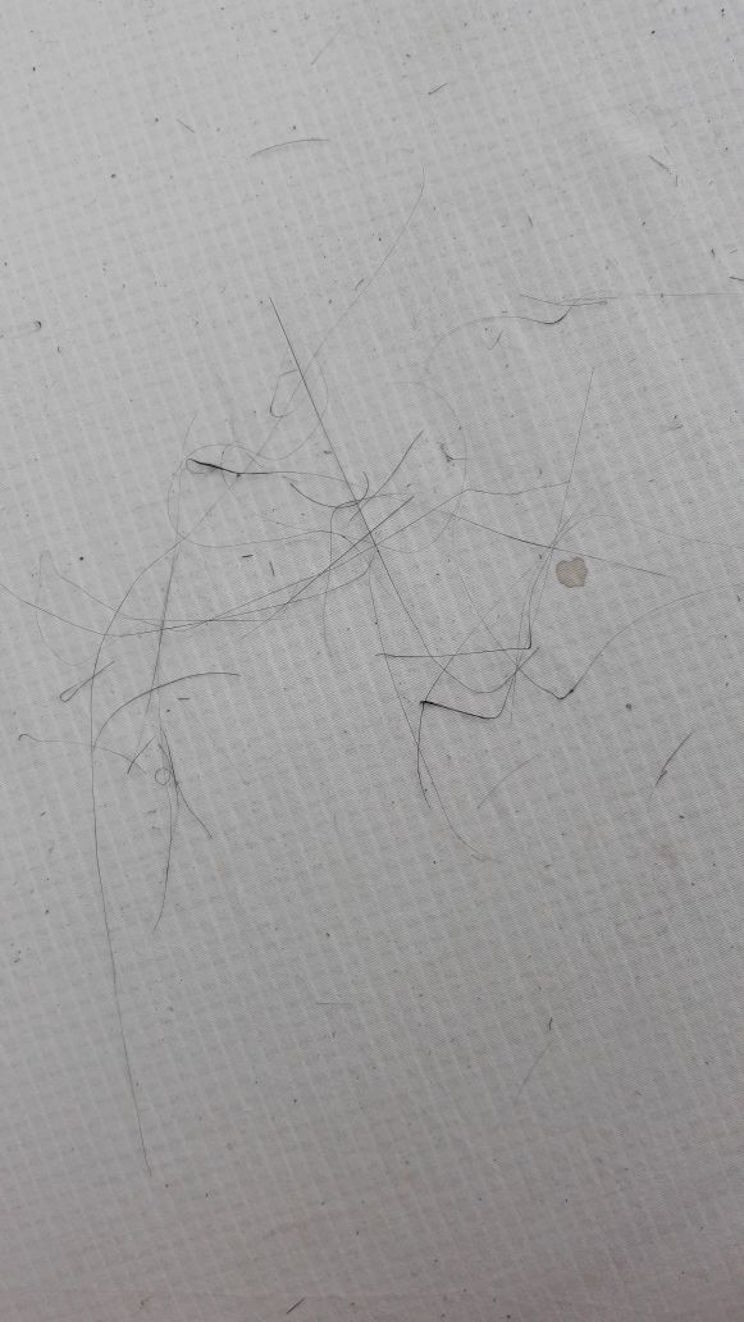 Cabello de Pel&eacute;