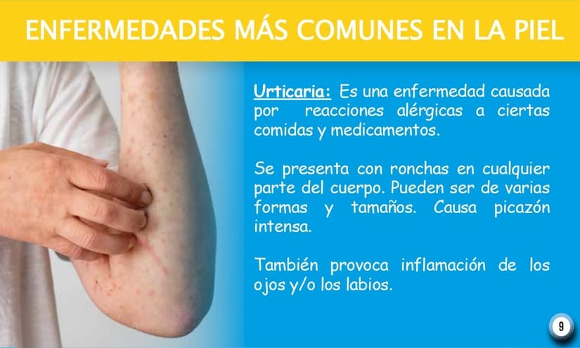 PIEL