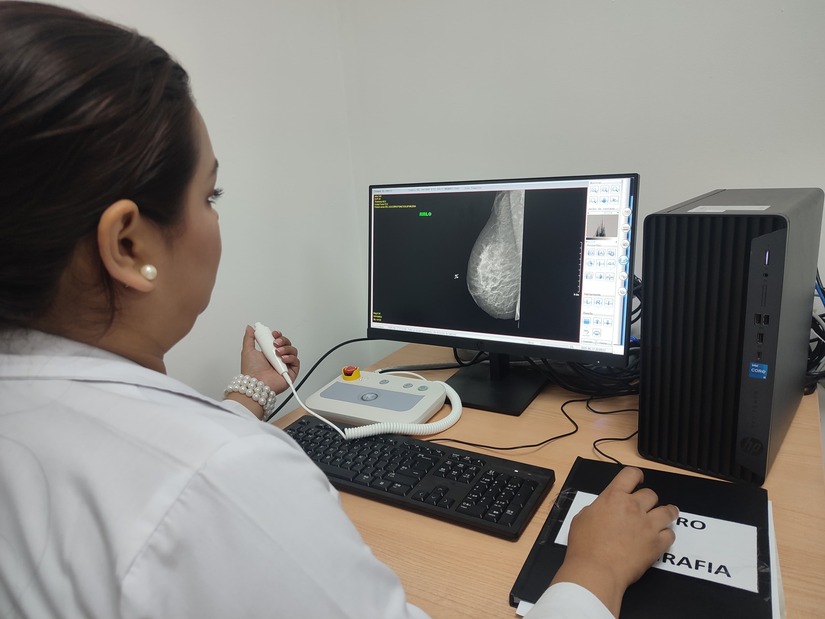 MAMOGRAFO11