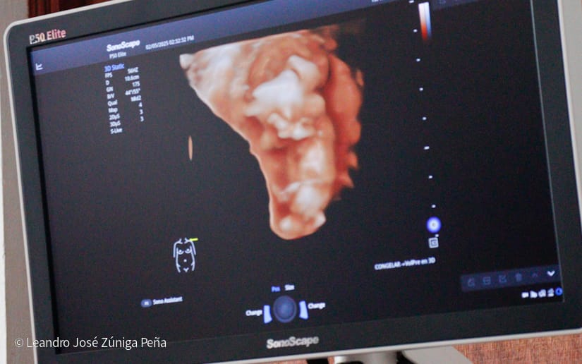 Entrega-de-Ultrasonidos-Nicaragua-15