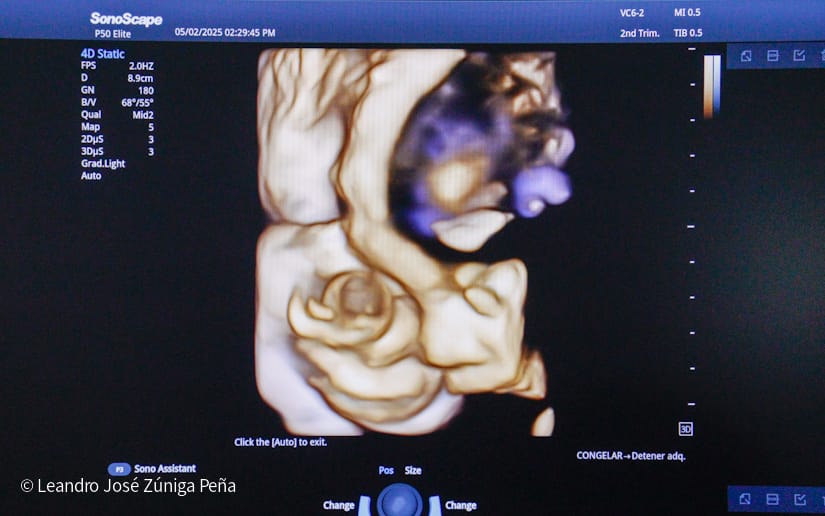 Entrega-de-Ultrasonidos-Nicaragua-19