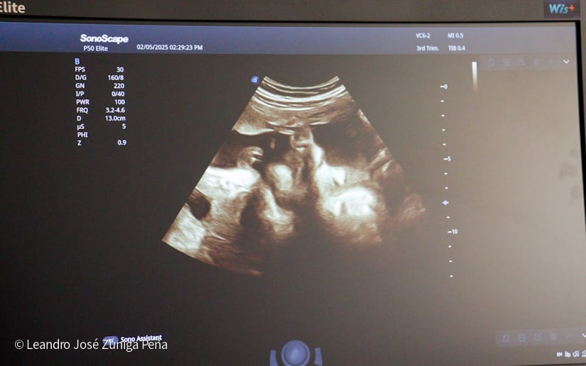 Entrega-de-Ultrasonidos-Nicaragua-22